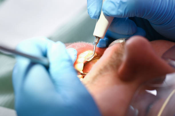 Best Emergency Dental Care for Broken or Chipped Teeth in Elizabethtown, KY